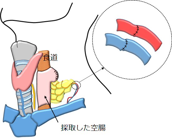 図27：遊離空腸移植