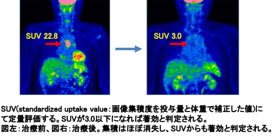 図14：FDG-PETによる治療効果判定