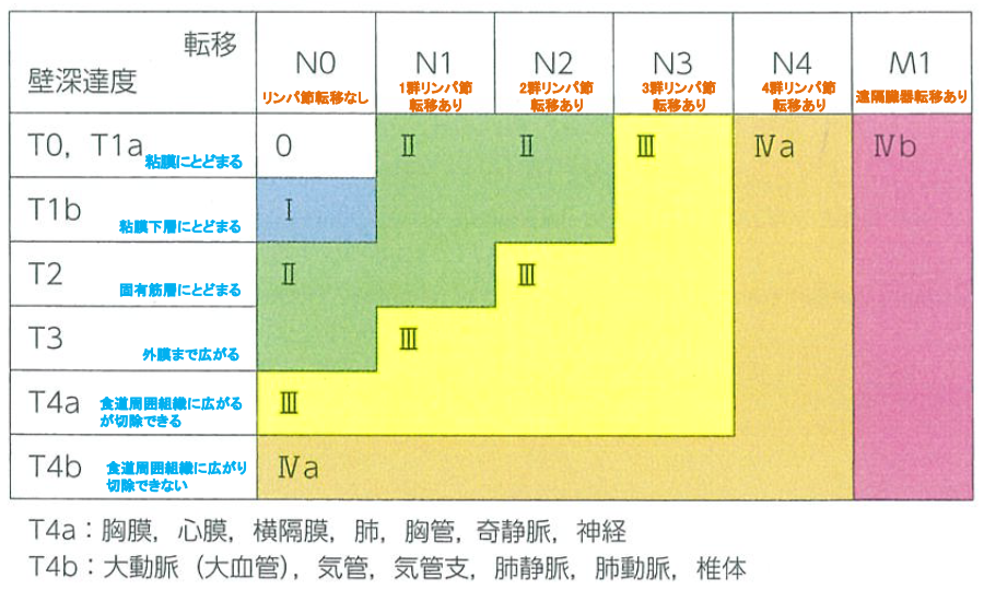 図14：食道がんの進行度（ステージ）分類（0～IVb）