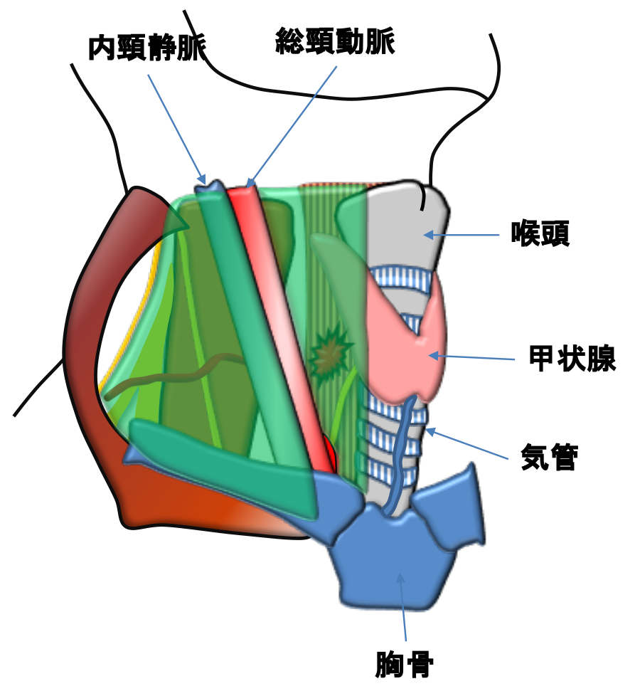 図21：頸部食道癌手術での切除範囲（緑色に囲まれた部分）