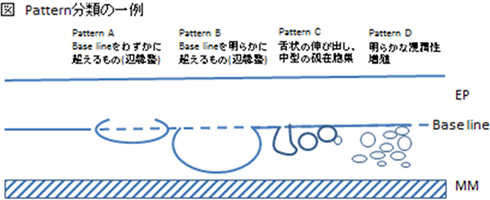 Pattern分類の一例